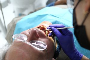 Poradnik po Ortodoncji: Jak Dbać o Zęby Po Założeniu Aparatu?